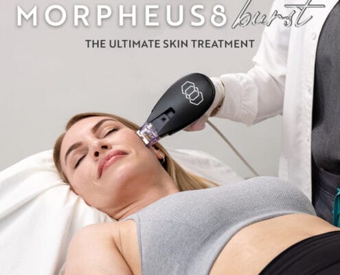 morpheus8